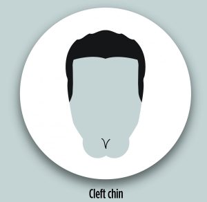 silhouette of cleft chin